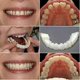 thumbnail image 5 of 4 Pack Snap On Smile Teeth Covers Cosmetic Dental Whitening Veneers For Temporary Use And Special Occasions [jkw], 5 of 5