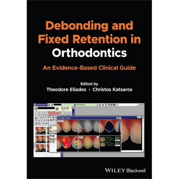 Debonding and Fixed Retention in Orthodontics: An Evidence-Based Clinical Guide, (Paperback)