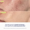 thumbnail image 4 of Crema hidratante en gel restauradora Skinfix Skin Barrier 50 ml, 4 of 9