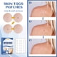 thumbnail image 3 of Seitruly Skin Set Professional Painless Warts Removing Moles Remover Labels Patch Removers Type2 NO2, 3 of 6