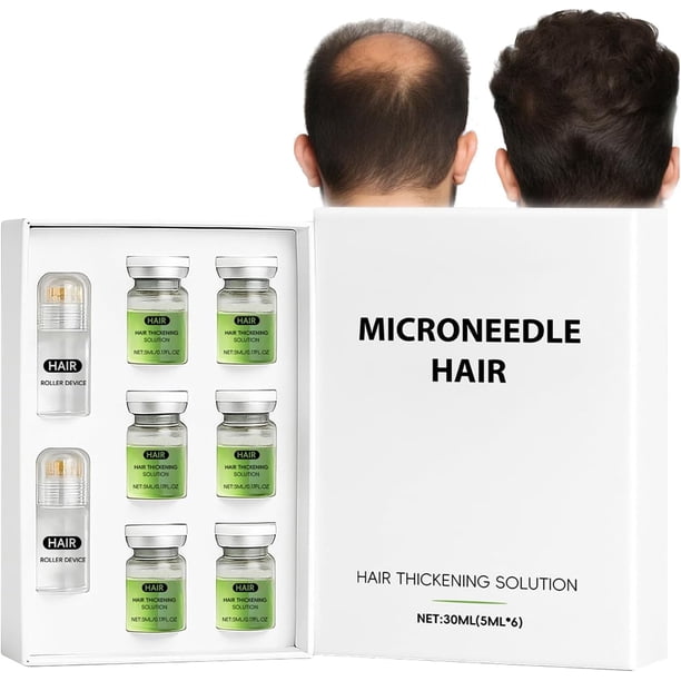 Yanonmyfd Suero de Crecimiento de Los Pelos De Micronesa, Tratamiento Avanzado de Crecimiento del Cabello,SéRum para el Crecimiento del Cabello, Tratamiento para MáS Gruesos, Fortalece Las RaíCes,