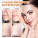 thumbnail image 5 of Ganfancp Parches de Colágeno Hidrolizado Parches de Colágeno Hidrolizado Cuello Película de Colágeno Soluble Highprime Película de Colágeno Mascarilla Facial Película de Colágeno Soluble 30Ml Ofertas, 5 of 7