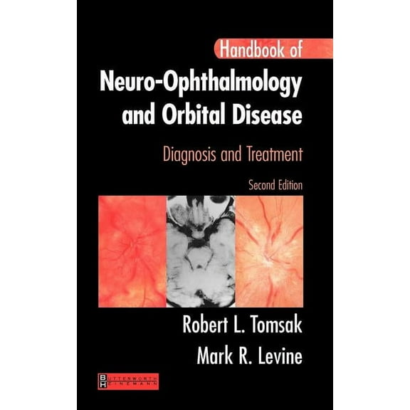 Handbook of Neuro-Ophthalmology: Diagnosis and Treatment (Paperback)