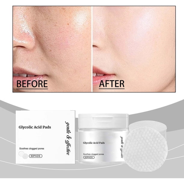 Discos exfoliantes con ácido glicólico: Reducen la opacidad, unifican el tono, retrasan el envejecimiento, hidratan profundamente y mejoran la firmeza. Esponja limpiadora exfoliante de cúrcuma (60 uni