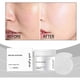thumbnail image 1 of Discos exfoliantes con ácido glicólico: Reducen la opacidad, unifican el tono, retrasan el envejecimiento, hidratan profundamente y mejoran la firmeza. Esponja limpiadora exfoliante de cúrcuma (60 uni, 1 of 9