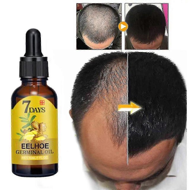 Leke 1pc Solución acondicionadora capilar de jengibre Solución nutritiva para el cabello, hidratante, reafirmante y anticaída 40 ml | 7332565040515