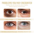 thumbnail image 3 of West Month Collagen Eye Mask Moisturizes And Moisturizes The Elastic Muscle Of The Eyes And Reduces The Fine Lines Of The Dark Circles Under The Eyes, 3 of 6