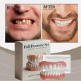 thumbnail image 3 of Custom Dental Retainer Aligner Set Invisible Comfort Fit Teeth Straightener for A Confident Smile, 3 of 8