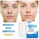 thumbnail image 4 of Buy 2 Get 3 Medicated Acne Patches For All Skin Types SpotStickers For Face And Skin To Get Ridof Pimples And Pimples 216pcs, 4 of 8