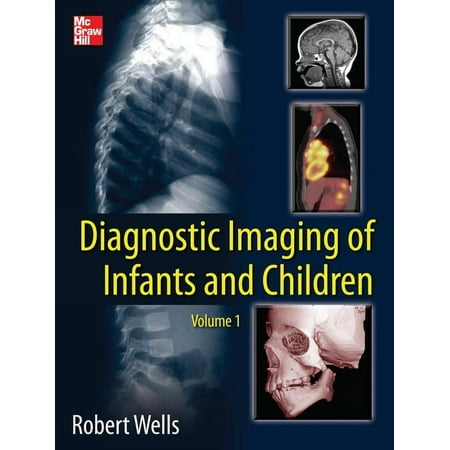 UPC: 9780071810036 | Diagnostic Imaging of Infants and Children (Hardcover)