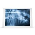 thumbnail image 2 of LED Visionneuse de Film Viewbox LED Panneau Plat A Conduit Viewbox Light Box Light Panel Pad pour la Maison de Dentiste Spectateur, 2 of 8