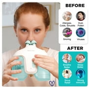 Nascool Electric Nasal Irrigation System with 50 Salt Packets, Sinus Rinse Cleaner & Nose Washer