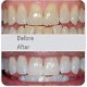 thumbnail image 4 of Cepillo de dientes eléctrico para adultos - Cepillos de dientes ultrasónicos en forma de U para blanquear los dientes - Limpieza bucal 360, protección de encías manos libres - Carga inalámbrica kaili Sencillez, 4 of 5