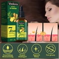 thumbnail image 4 of Sérum para el crecimiento del cabello Vedora King of Ginger con biotina 90 ml, 4 of 9
