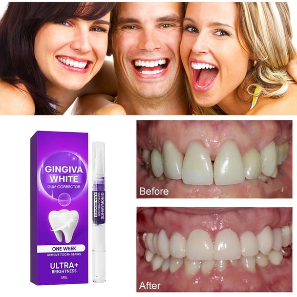 Bolígrafo blanqueador dental profesional, gel de 3 ml, diseño ergonómico, para uso diario, resultados rápidos, apto para viajes, punta de acero inoxidable, kit de viaje para oficina.