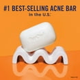 thumbnail image 3 of PanOxyl Acne Treatment Bar with 10% Benzoyl Peroxide, 4 oz, 3 of 11