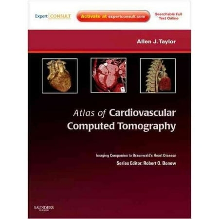 Atlas of Cardiovascular Computed Tomography: An Imaging Companion to Braunwald's Heart Disease