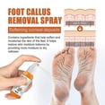 thumbnail image 5 of OUHOE Spray exfoliante para pies, repara callos en los talones, piel muerta, spray hidratante antiagrietado para el cuidado de los pies | |, 5 of 5
