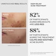 thumbnail image 4 of Tratamiento para el acné Murad Deep Relief Acne Control, 30 ml, 2% de ácido salicílico, 4 of 8