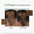thumbnail image 4 of Rene Furterer Triphasic Progressive Thinning Hair Routine, 4-Piece Set, 4 of 5