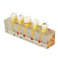 thumbnail image 3 of Modelo de diente de caries BuyWeekMX Modelo de dientes de enseñanza Compacto y liviano, 3 of 9
