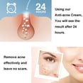 thumbnail image 3 of Crema para eliminar el acné, crema para espinillas, crema Facial hidratante de reparación para el cuidado de la piel, 30ml, 3 of 8