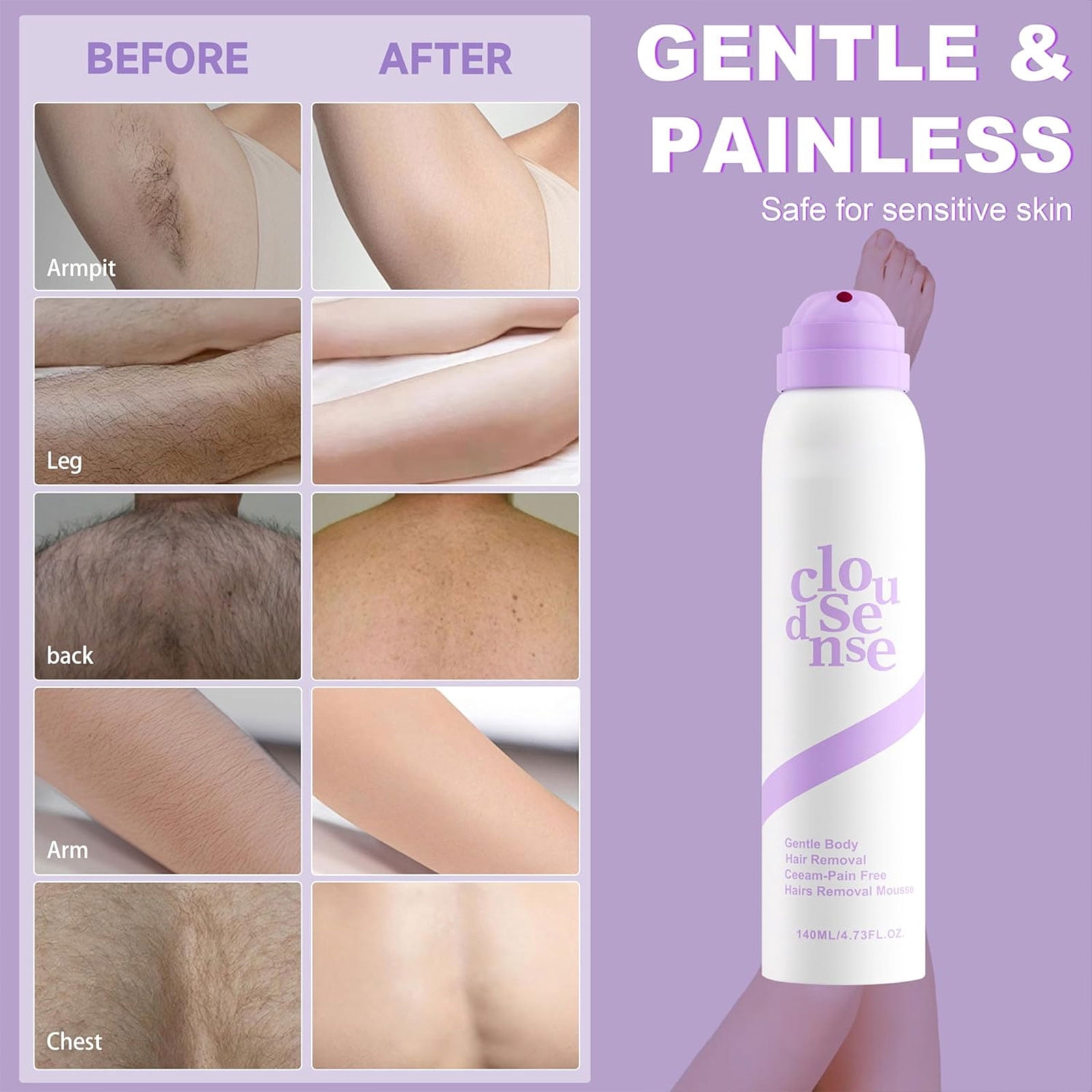 Cloud Sense Hair Removal Spray, Smooth Hair Removal Spray, Bikini Pain Free Hair Removal Spray, Skin-Loving Ingredients, Suitable for Every Skin Type and Corner Women and Men (Spray*1)