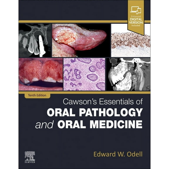 Cawson's Essentials of Oral Pathology and Oral Medicine