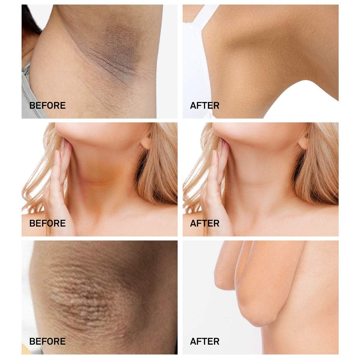 whitening cream neck