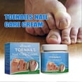 thumbnail image 3 of Toenails Nail Care Cream, Nail Fungus Treatment Cream, Toe Nail Fungus Treatment Nail Repair Care Cream, 3 of 5