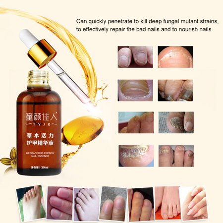 Tyjr nail serum fungal nail remove onychomycosis toe nail nourishing TYJR Nail Serum Fungal Nail Remove Onychomycosis Toe Nail Nourishing
