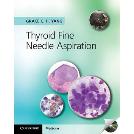 Xtra Compact - Thyroid Fine Needle Aspiration with CD Extra