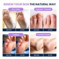 thumbnail image 5 of Foot Cure Soothing Lavender Foot Soak - Pedicure Foot Spa with Epson Salts for Soaking Feets, Athlete's Foot, Callus Softening, Foot Odor Scent 16oz, 5 of 10
