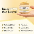 thumbnail image 6 of ECZEMA HONEY Original Skin-Soothing Cream - Organic Hand & Body Eczema Relief - Natural Honey Lotion for Dry, Itchy, & Irritable Skin (4 Oz), 6 of 6