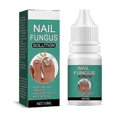 thumbnail image 4 of Nail Fungal Treatment Feet Care Essence Anti Infection Paronychia Onycho, 4 of 5