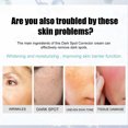 thumbnail image 3 of Crema correctora para rostro y cuerpo, elimina manchas oscuras, melasma, manchas oscuras de tipo avanzado, con retinol, para mujeres, 30 g., 3 of 5