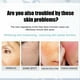 thumbnail image 5 of Crema Correctora de Manchas Oscuras para Rostro y Cuerpo | Crema Correctora de Manchas de La Edad, Manchas Marrones y Melasma con Retinol | 30 G | Loción Facial para Mujeres, 5 of 7