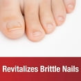 thumbnail image 3 of Kerasal Fungal Nail Nighttime Nail Patches, Restores Discolored or Damaged Nails, 14 Ct, 3 of 13
