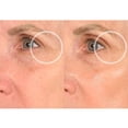 thumbnail image 3 of Patchs Anti-Rides SiO Beauté Yeux et Sourire Lift ApproviSiOnnement de 2 Semaines, 3 of 9