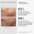 thumbnail image 4 of Murad Deep Relief Acne Spot Treatment with 2% Salicylic Acid – Patch-Like Liquid Treatment for Deep, Hormonal Acne & Breakouts – 1 Fl Oz, 4 of 8