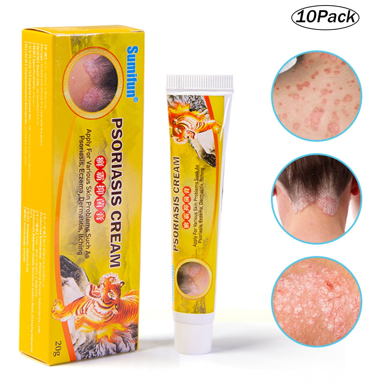 Alloet 10Pack Psoriasis Cream Eczema Ointment Scalp Psoriasis Hand Tinea Foot Odor Cream