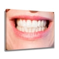 thumbnail image 2 of Póster de lienzo con dientes blancos para mujer, decoración de dormitorio, paisaje deportivo, decoración de oficina, regalo, estilo marco, 12 x 18 pulgadas (30 x 45 cm), 2 of 8