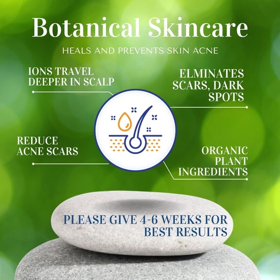 Organic Life Scalp-Care Serum – Gentle Herbal Anti-Dandruff Formula, 4 fl oz