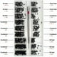 thumbnail image 2 of LEEYNEER - Kit de 500 tornillos de reparación microdiminutos con destornillador, surtido de tornillos pequeños de acero inoxidable, 18 tamaños para gafas, portátiles, joyas, 2 of 5