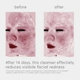 thumbnail image 4 of EltaMD Skin Recovery Amino Acid Foaming Facial Cleanser, Gentle Face Cleanser for Sensitive Skin, 5oz bottle, 4 of 10