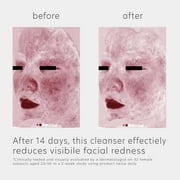 EltaMD Skin Recovery Amino Acid Foaming Facial Cleanser, Gentle Face Cleanser for Sensitive Skin, 5oz bottle
