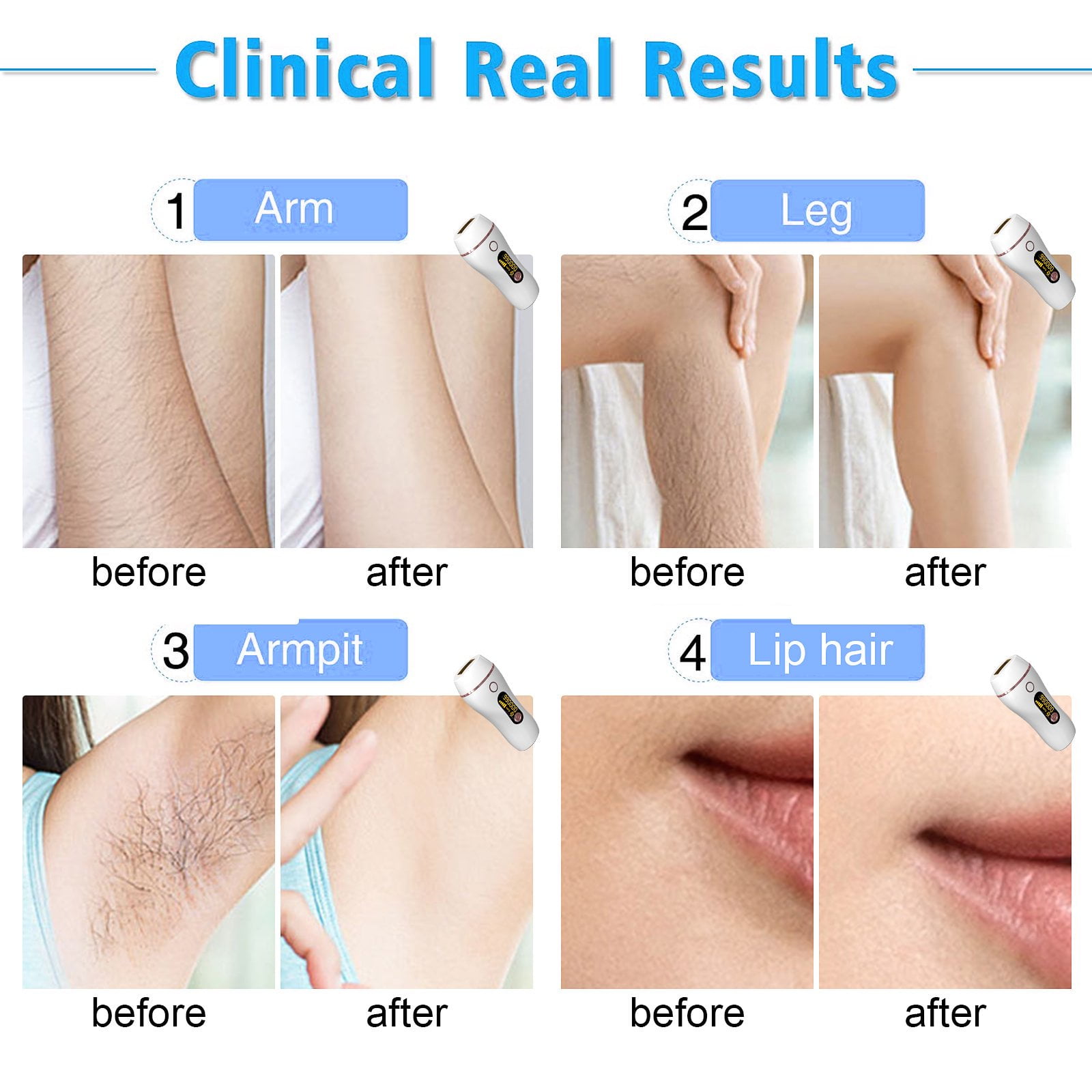 ボディ・フェイスケア Photo flash / hair removal / ボディ・フェイスケア Photo flash / hair removal / ヤーマン