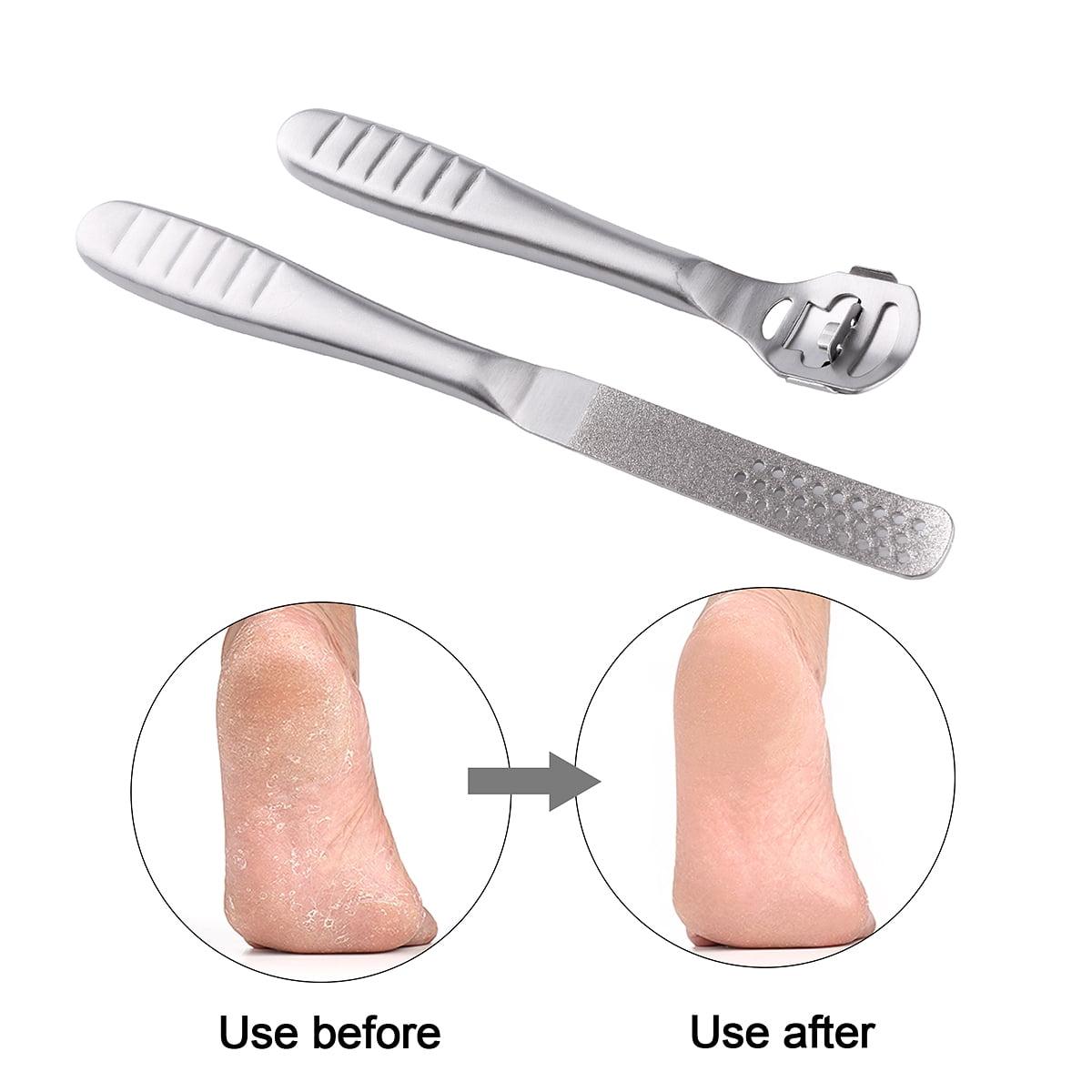 2pc Metal Foot File Scraper Pedicure Callus Remover Scrubber Hard Roug —  AllTopBargains