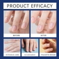 thumbnail image 5 of Cuticle Remover Cream -Gentle Keratin Removal And Nail Care Gel 30ml, 5 of 5