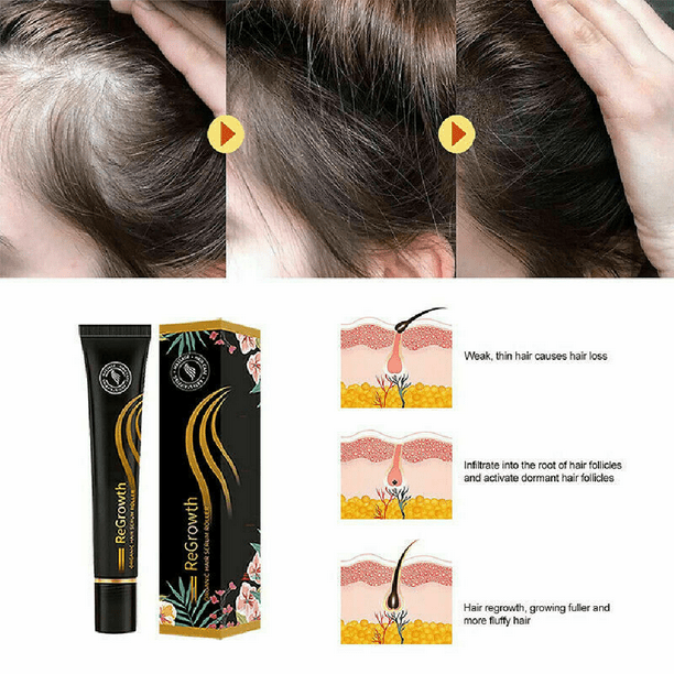 Regrowth Organic Hair Serum Roller Set, Hair Care Anti Stripping Liquid  20ml 